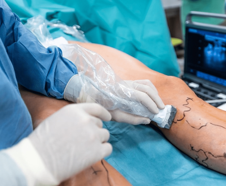 Vascular Surgery
