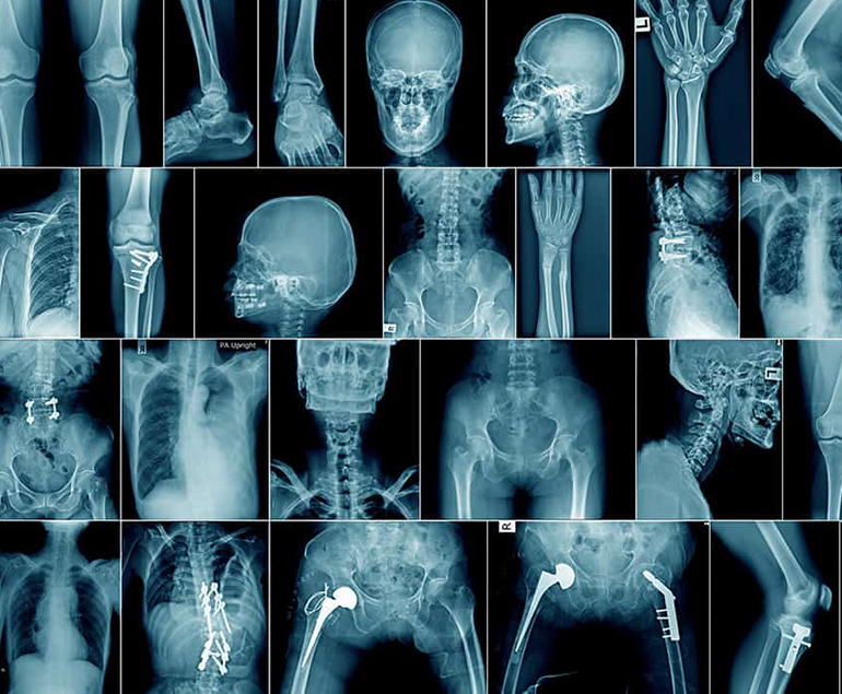 Radiology